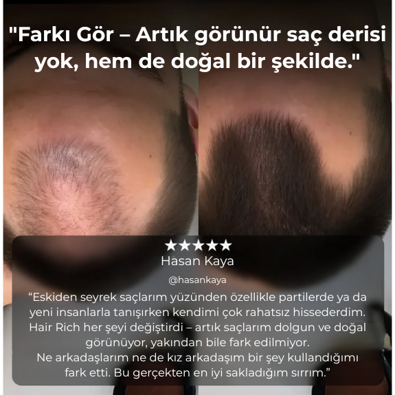 Hair Rich ™ Saç Yoğunlaştırıcı Fiber Toz – Anında Dolgun Görünüm