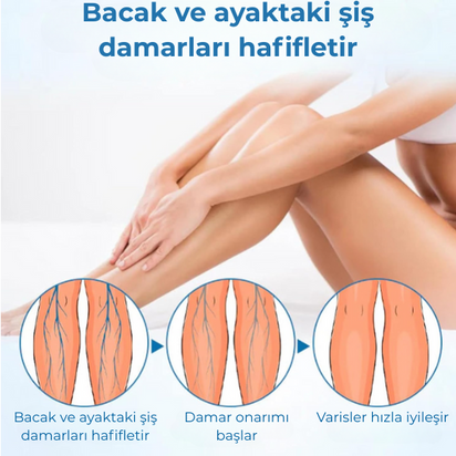 Timilk® VeinGuard Bitkisel Sprey – ✅ Klinik olarak kanıtlanmış etkisiyle sadece 7 günde varis görünümünü azaltır!